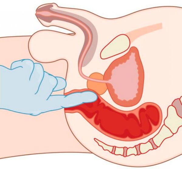 Stimulation du point G chez un homme par l'anus